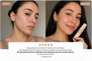 Stick Modelador de Cicatrices de Acne® M&K