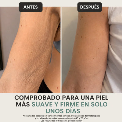 Crema Antiedad de Grado Clínico M&K